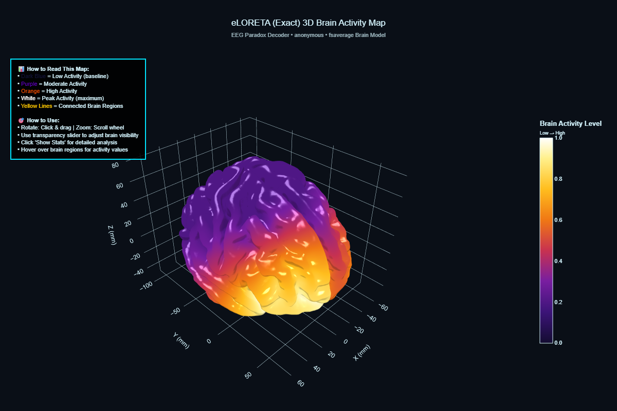eLORETA 3D brain activity map showing source-localized power on the cortical surface