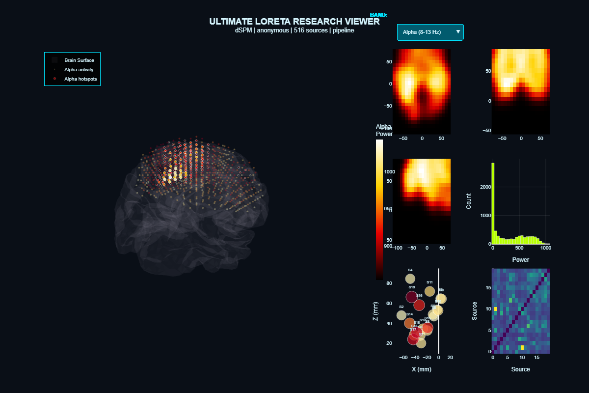 Ultimate LORETA Research Viewer with 7 panels including 3D brain, slices, scatter, and source matrix