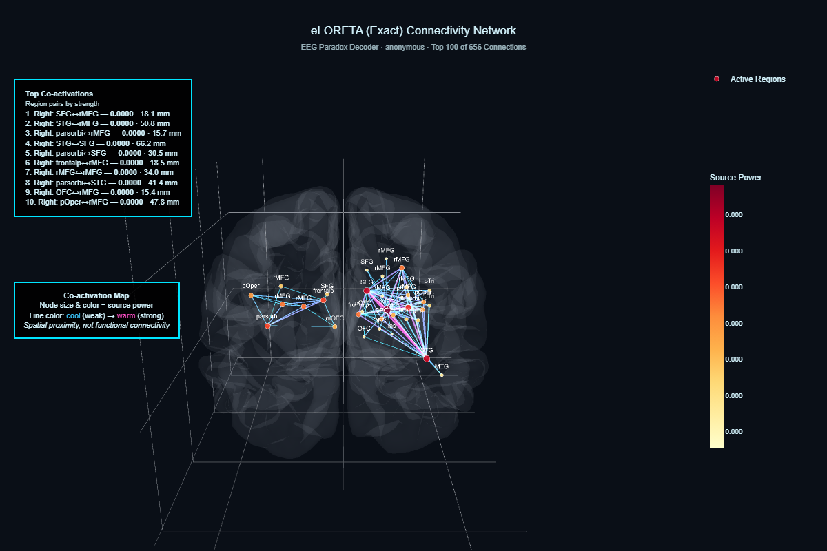 eLORETA connectivity network showing co-activation between brain regions